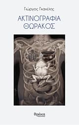 Ακτινογραφία θώρακος